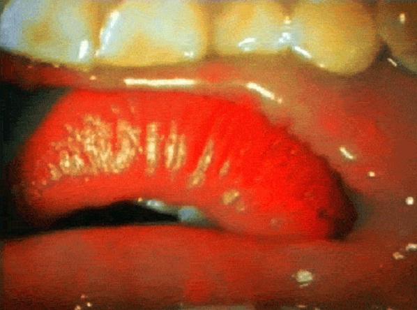 Com E Un Bacio Visto Da Dentro La Bocca Radio 105