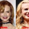 Nicole Kidman