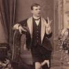  L’uomo aragosta. 