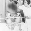 I trattamenti per il rachitismo infantile sembrano usciti da un film horror.