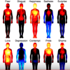 2. Temperatura