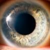 2. Dilatazione delle pupille