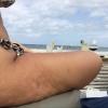 La Graham mostra le imperfezioni della sua gamba, tra cellulite e smagliature