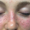 1. La nuova moda del freckling