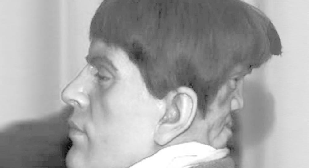 L'uomo con due facce
