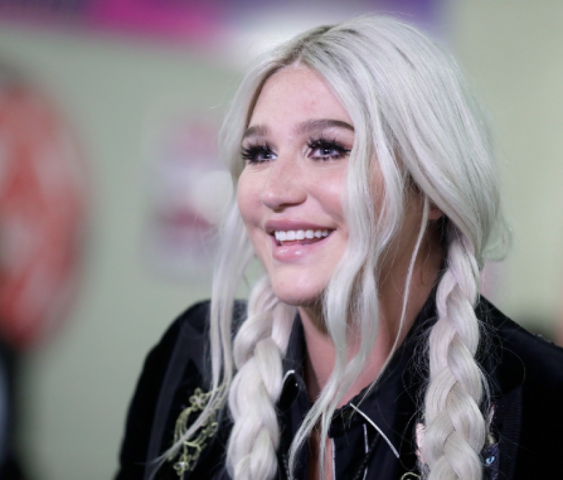 3. Kesha