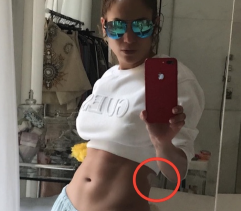 Jennifer Lopez e il fianco bucato