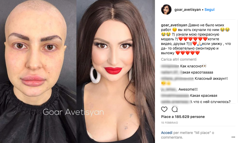 Con i suoi pennelli Goar riesce a “scavare” sotto le cicatrici della malattia riportando alla luce la bellezza originaria delle sue modelle