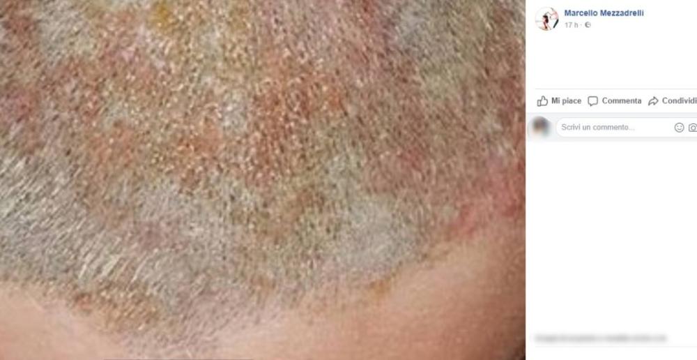 "Per farmi il colore mi hanno rovinato tutti i capelli”
