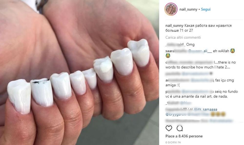 Avere denti bianchi è un'impresa impossibile?