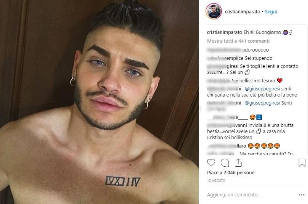Su Instagram sono arrivate le accuse, per il ragazzo, di essersi rifatto