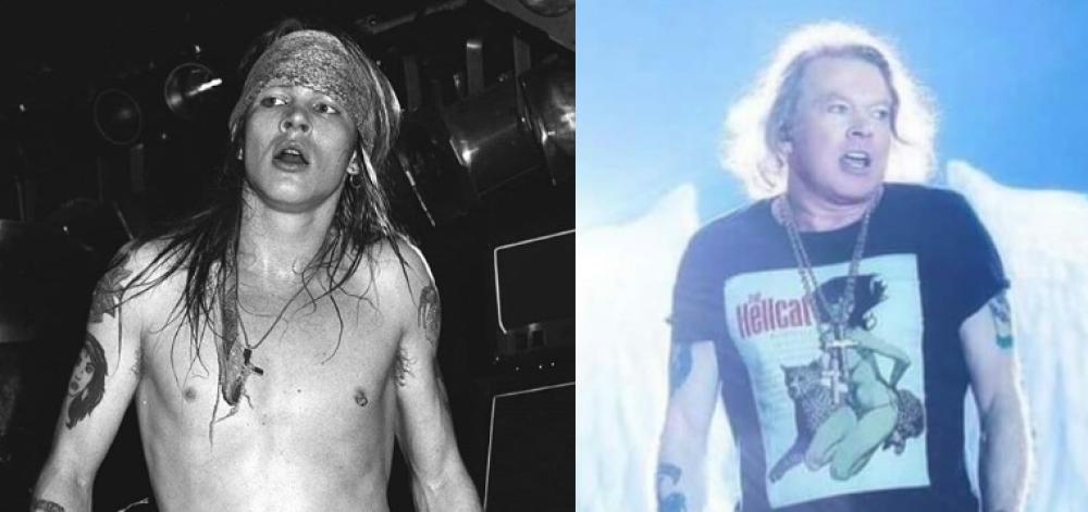 Axl Rose prima e dopo