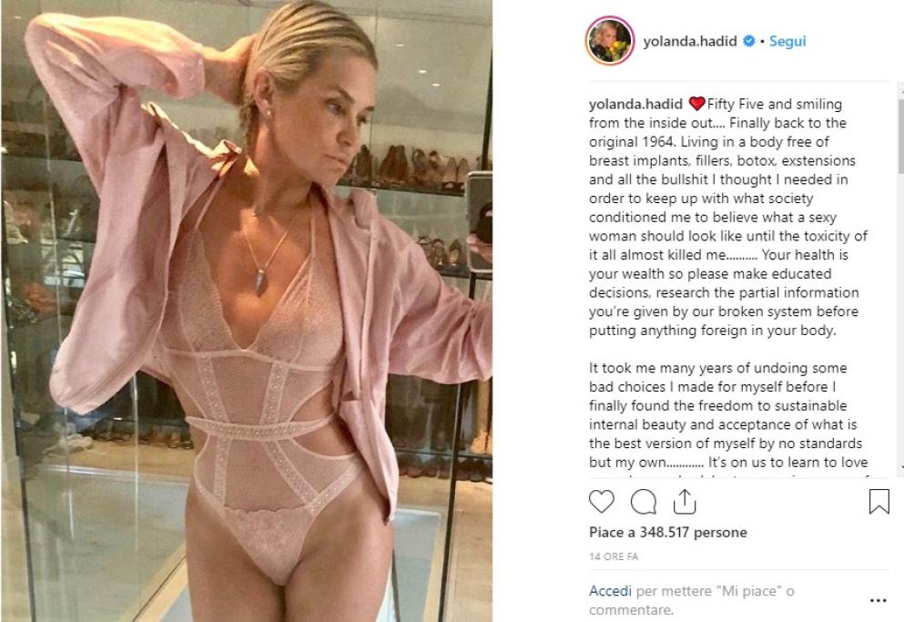 Yolanda mostra il suo corpo libero dalla chirurgia estetica