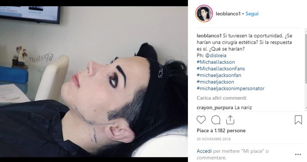 Gli interventi non bastano mai