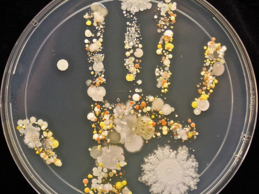 Questo è quello che resta sulla mano di un bambino di 8 anni visto al microscopio