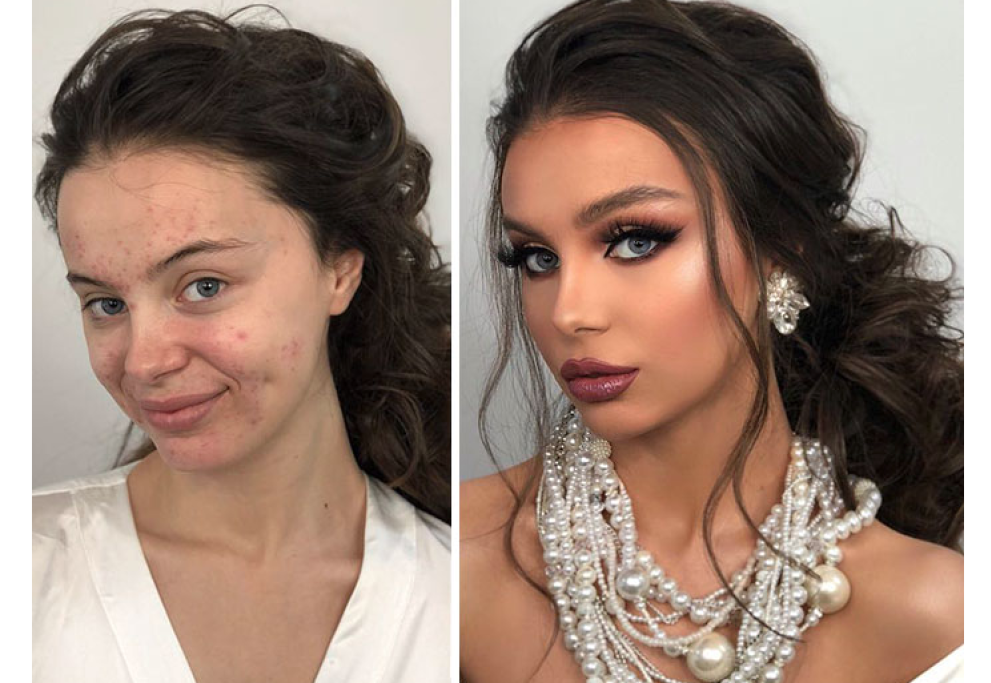 Prima e dopo