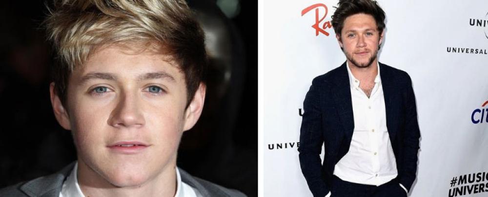 Niall Horan quando è entrato a far parte dei One Direction voleva essere famoso come Beyoncé e Justin Bieber.
