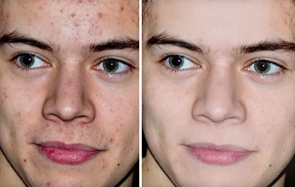 Harry Styles dei One Direction