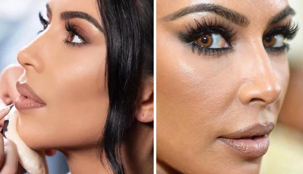 Kim Kardashian ha dei problemi di pelle