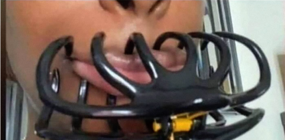 Mettere il mollettone sulle labbra