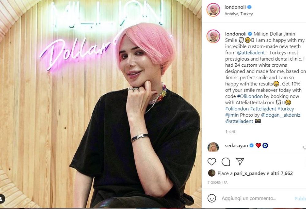 Oli London e i 18 interventi per diventare coreano: “Sono transrazziale”