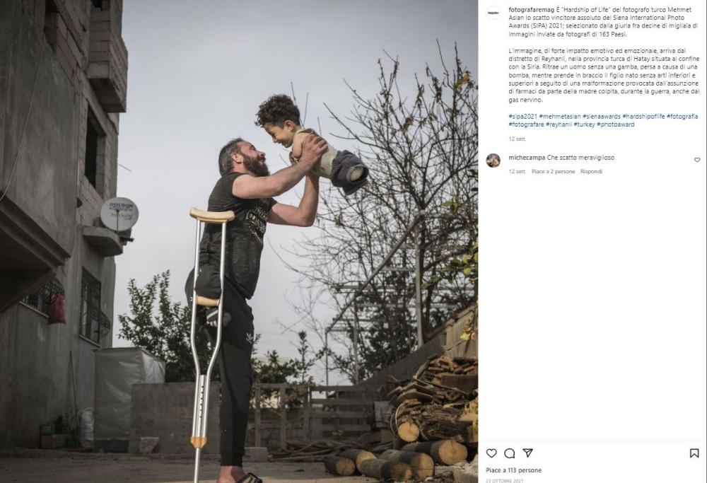 Arrivano a Siena Muznir e Mustafa, papà e figlio senza arti simbolo della guerra in Siria 