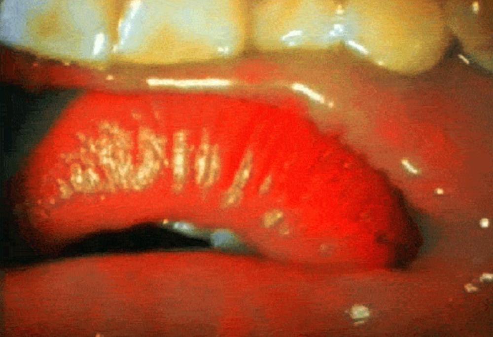 Com'è un bacio visto da dentro la bocca?