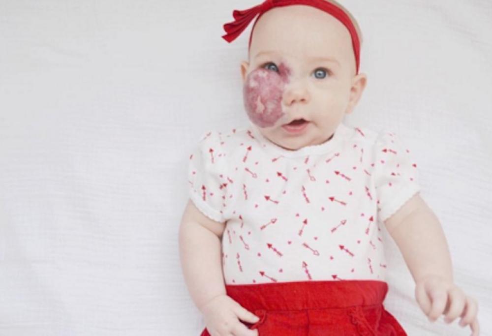 L'amore di una mamma per la sua bambina particolare