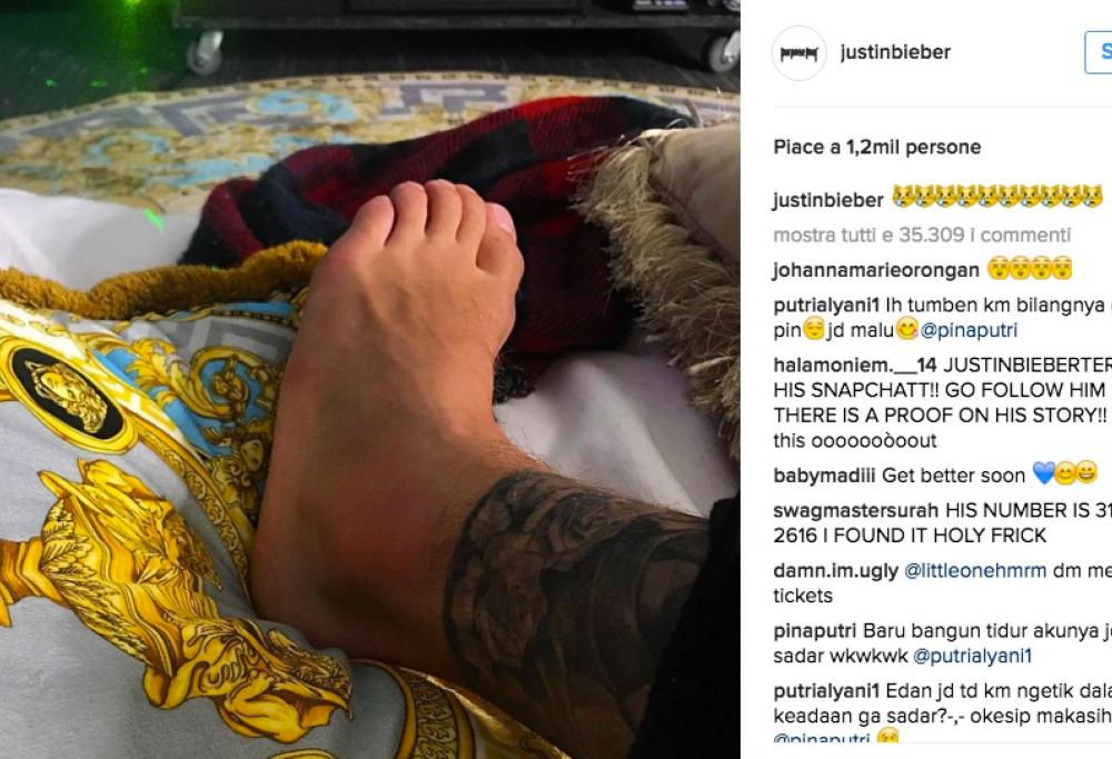 Justin Bieber: caviglia slogata ma il tour continua