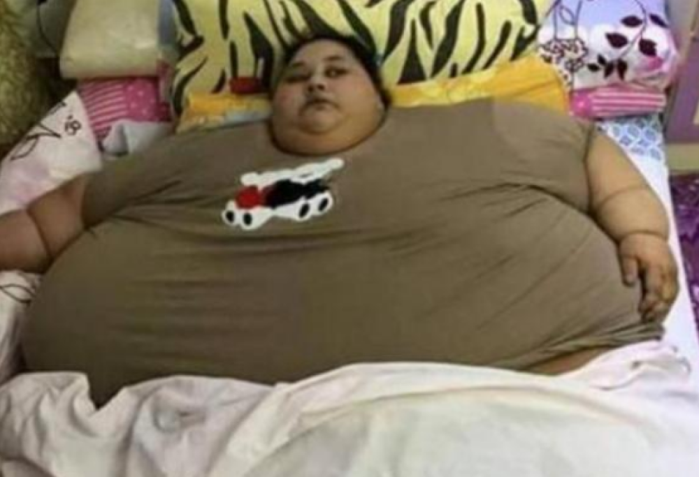 La donna più grassa del mondo vuole dimagrire: pronta a operarsi per perdere 390 kg