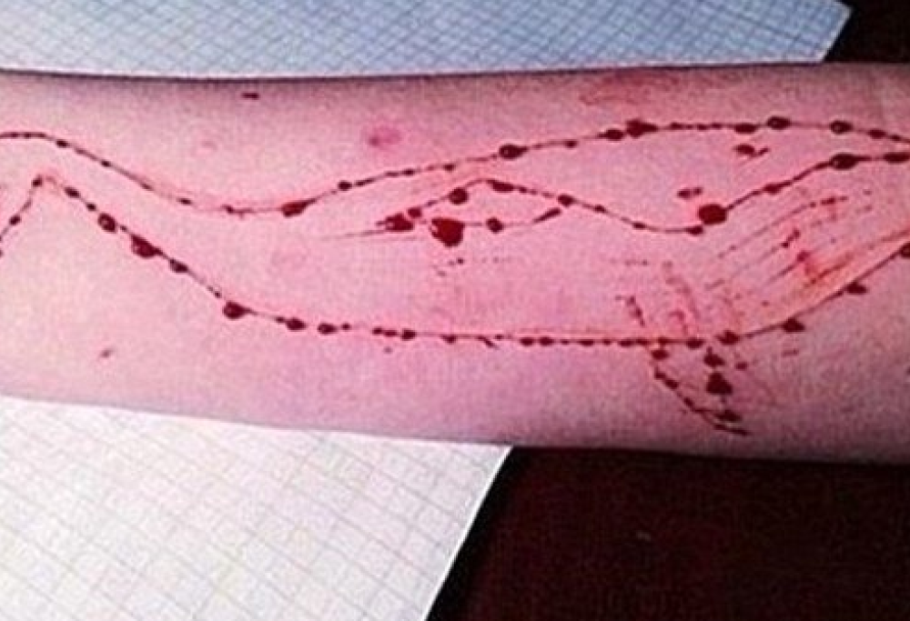 Blue Whale, un “gioco” che è costato la vita a 130 ragazzi