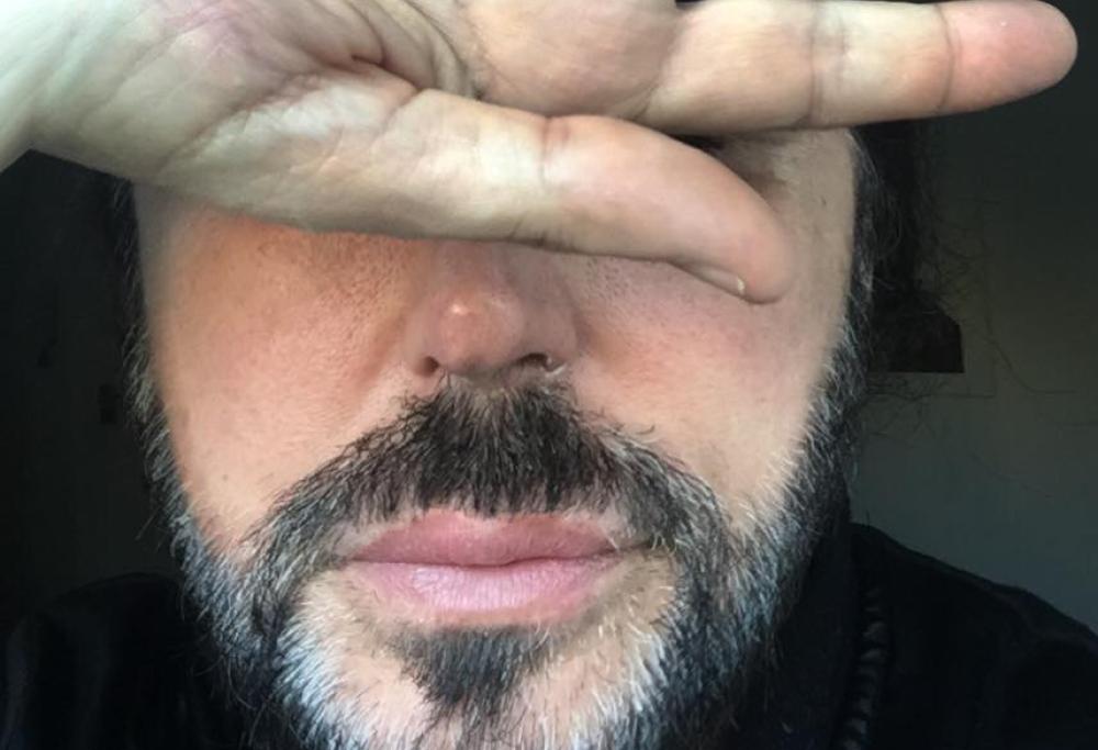 Scialpi vittima un episodio di omofobia