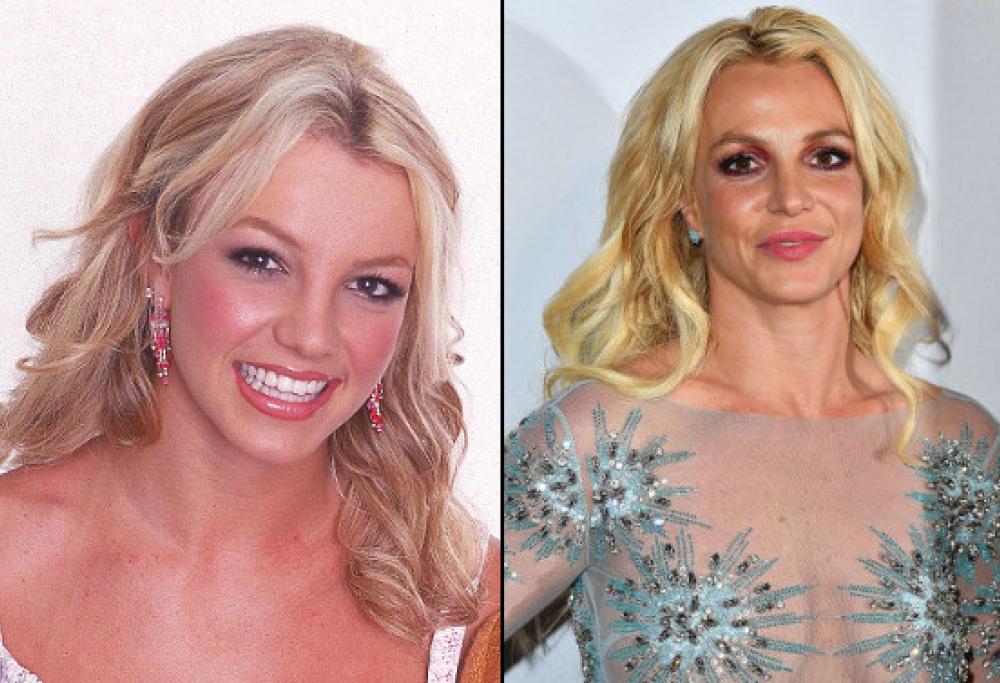 Britney Spears: il ritocchino c'è, parola di chirurgo