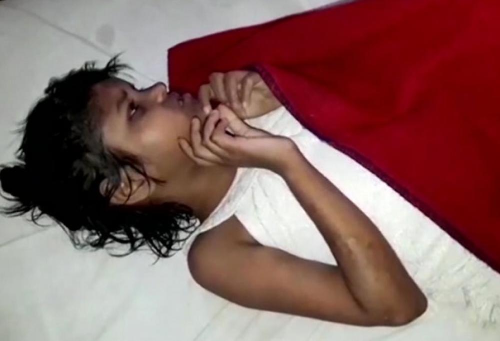 La bambina-Mowgli allevata dalle scimmie? È una bufala