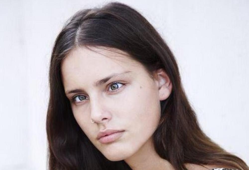 Modella strabica: Moffy rivoluziona la moda