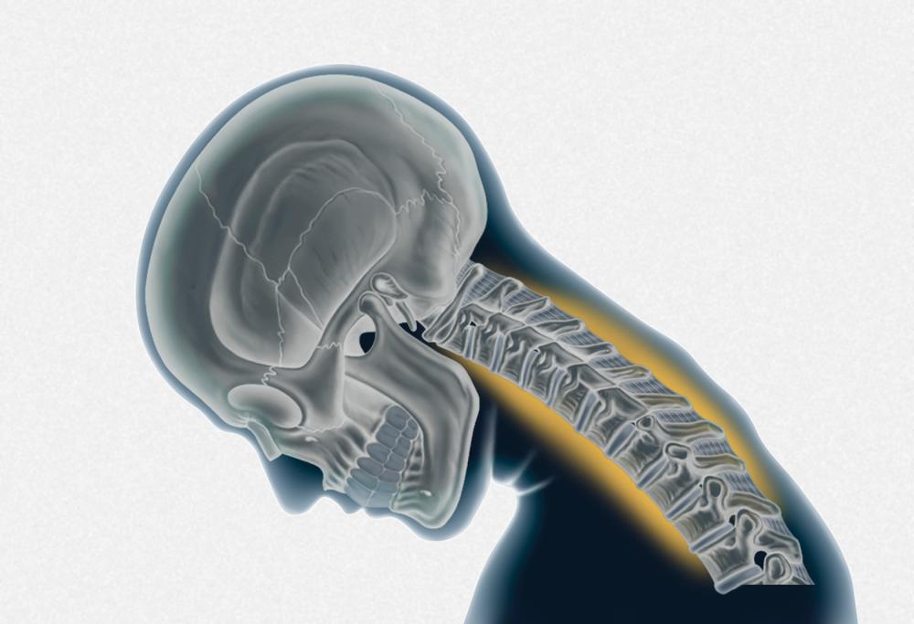 Pericolo smartphone: mentre li usiamo danneggiamo la colonna vertebrale
