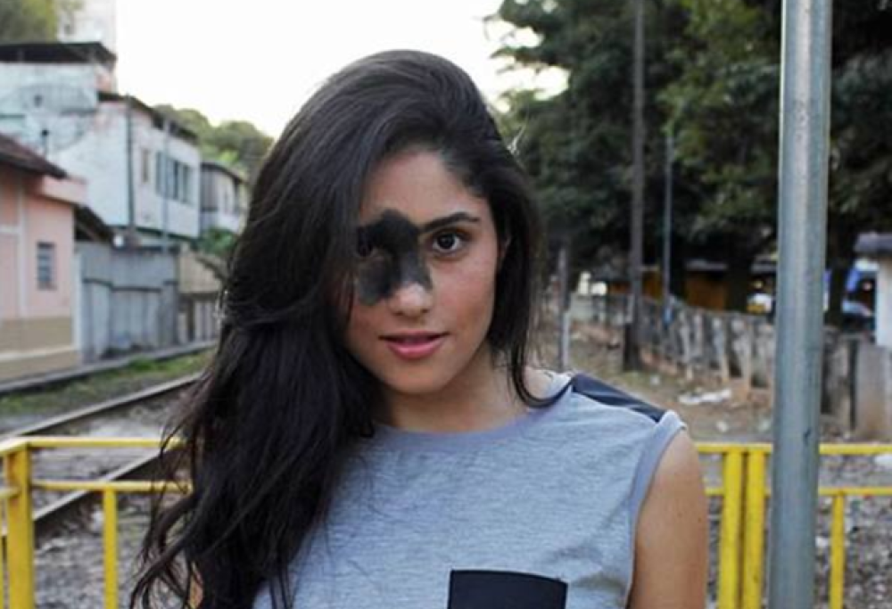 Mariana, la modella con una voglia nera sul viso