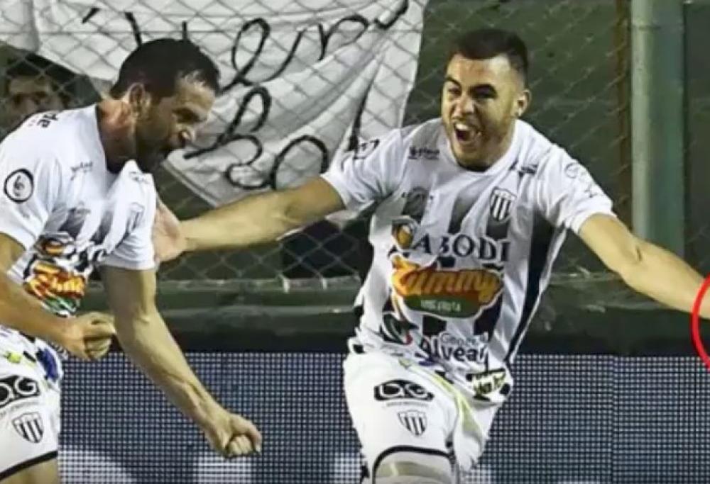 Calcio: usa un ago per fermare l’avversario. Difensore argentino nei guai