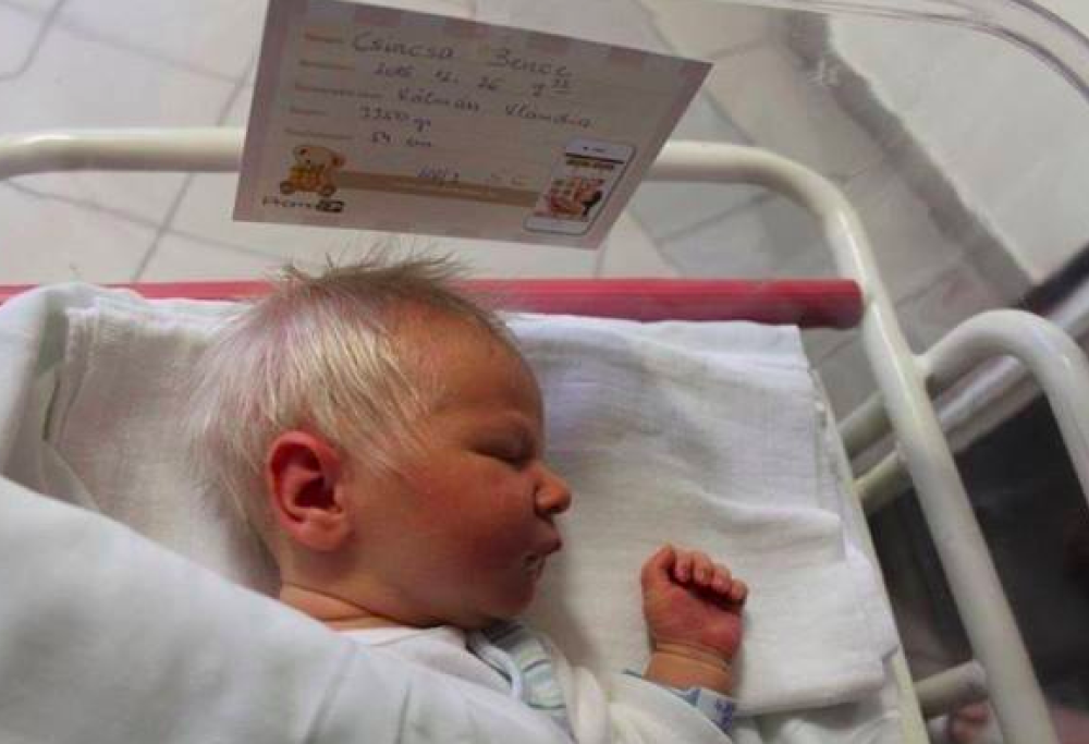 Incredibile in Ungheria: un bambino è nato con i capelli bianchi!
