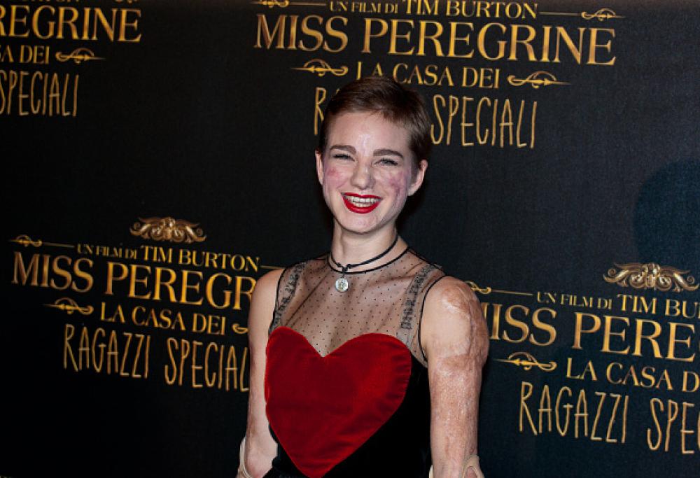 Bebe Vio: "La vita è una figata!"