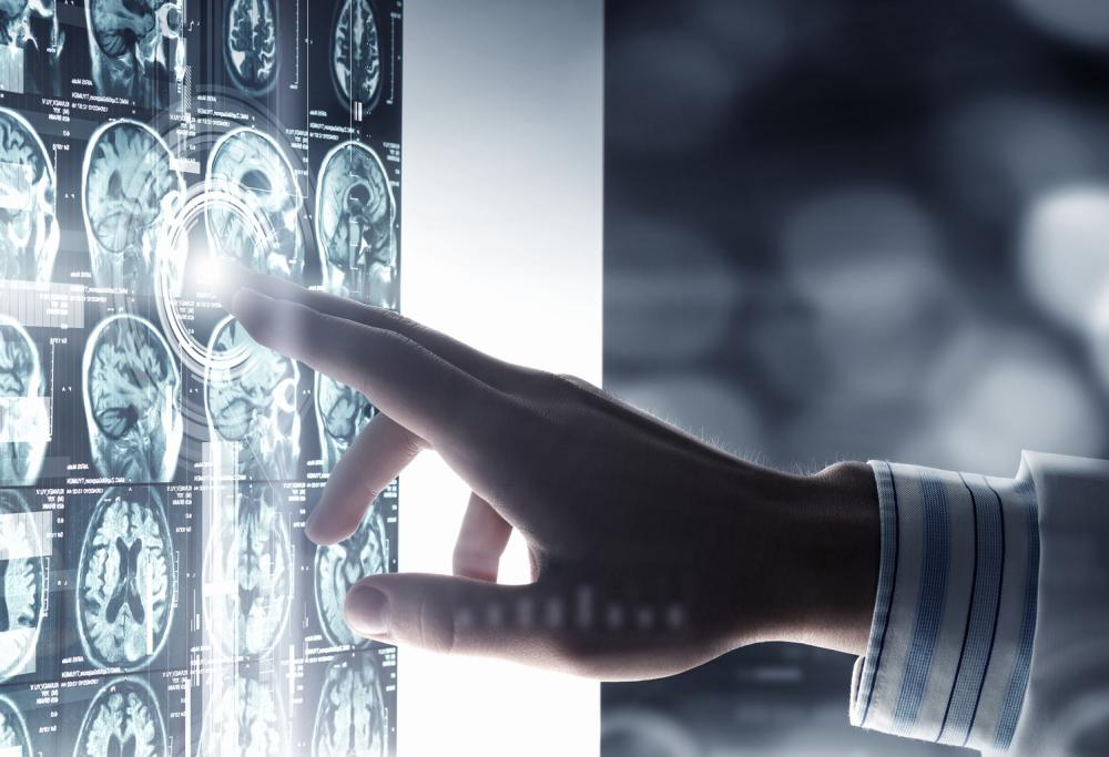 Il cervello non è capace di ricordare i dettagli fino all'età di 14 anni