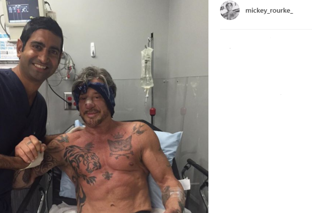 Ancora trasformazioni per Mickey Rourke: eccolo con un nuovo naso!