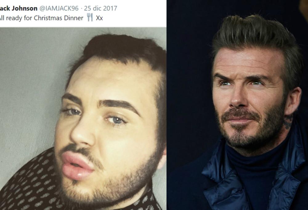 Spende 23 mila euro per assomigliare a Beckham ma il risultato è questo...