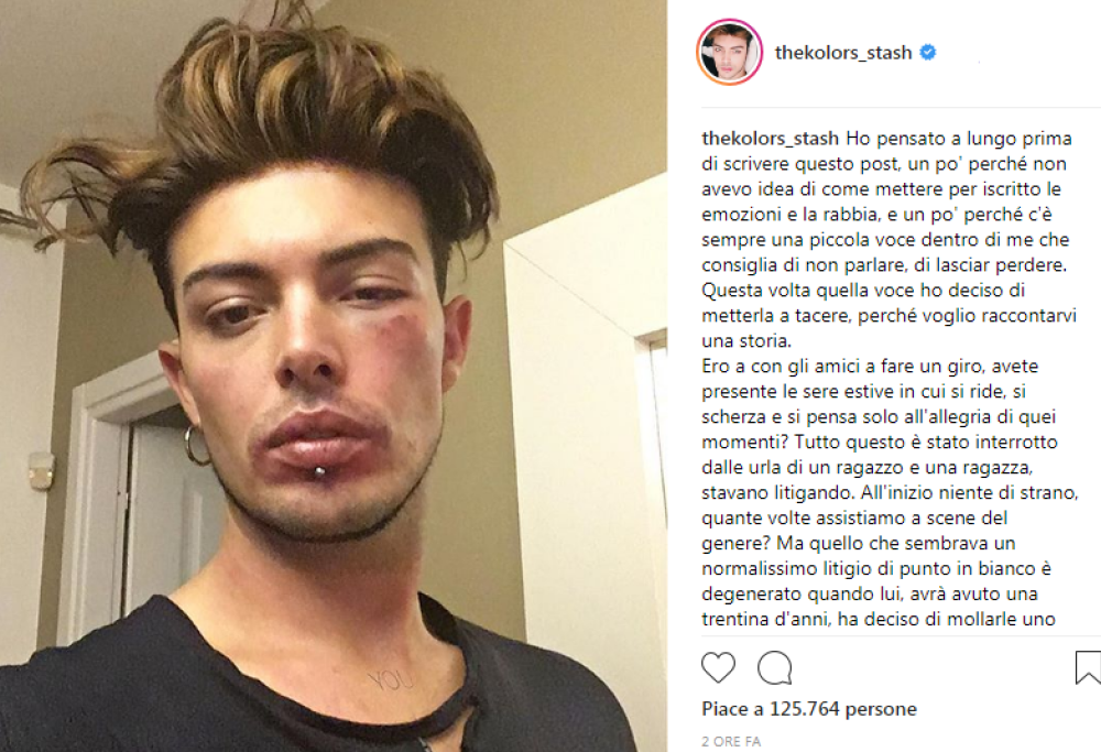 Stash dei The Kolors coinvolto in una rissa per difendere una ragazza: "Quando vedere un'ingiustizia, agite"