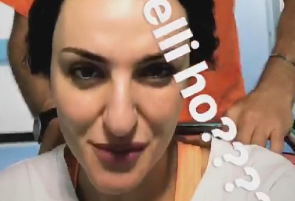 Arisa in ospedale per una botta alla testa