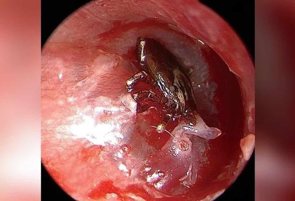 Bimbo ha dolori all'orecchio,  i medici scoprono una presenza inquietante al suo interno