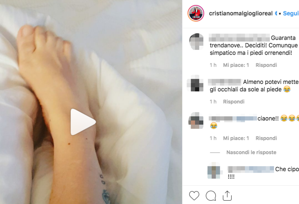 Malgioglio posta un video del suo piede “che balla la salsa” e lo attaccano: “Sembra un cotechino”