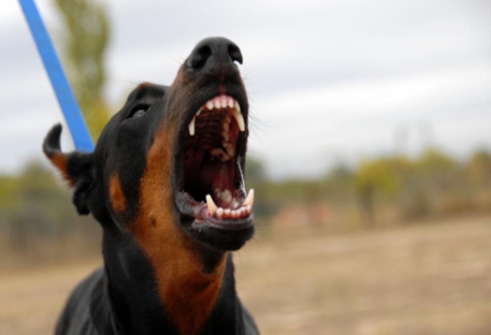 Donna azzannata da un dobermann: “Il padrone se n’è andato ridendo, aiutatemi a trovarlo”