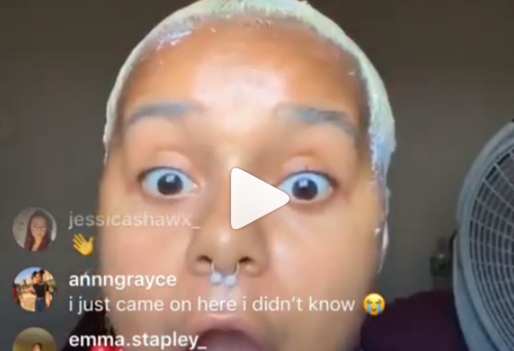Perde tutti i capelli in diretta Instagram, ma ne esce alla grande