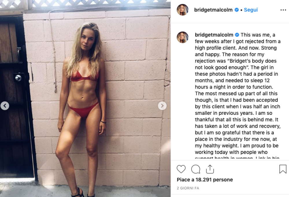 Modella licenziata perché troppo grassa: lo sfogo di Bridget Malcolm